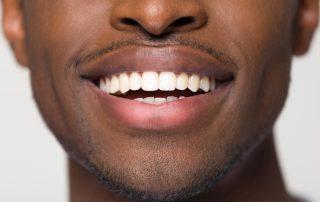 black man with straight teeth